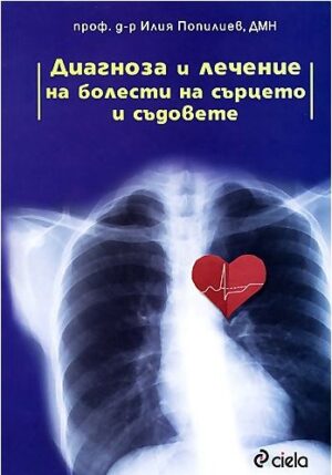 Диагностика и лечение на болести на сърцето и съдовете
