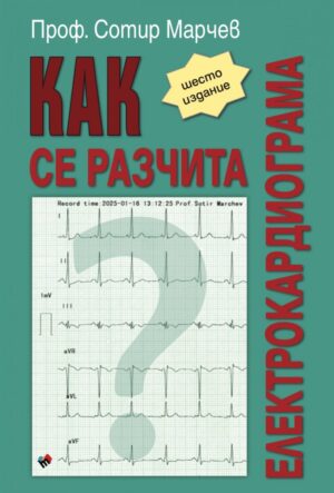Как се разчита електрокардиограма