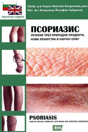 Псориазис - лечение чрез природни продукти, нови лекарства и научен опит