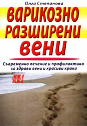 Варикозно разширени вени